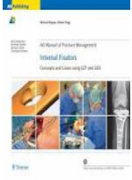 AO Manual Of Fracture Management: Internal Fixators: Concepts And Cases Using LCP/LISS 