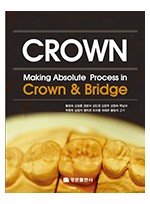 Making Absolute process in crown & bridge (개정3판)