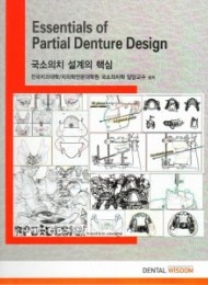 국소의치 설계의 핵심 Essentials of Partial Denture Design