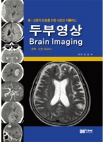 중 고령자 진료를 위한 뇌영상 아틀라스 두부영상 Brain Imaging  