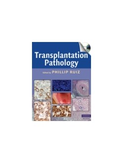 Transplantation Pathology