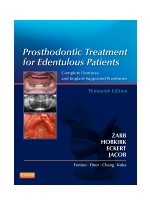Prosthodontic Treatment for Edentulous Patients, 13th 