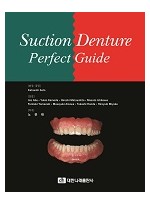 Suction Denture Perfect Guide 
