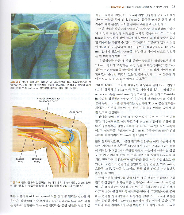 주관절경과 수근관절경(AANA Advanced Arthroscopy:The Elbow and Wrist)  DVD