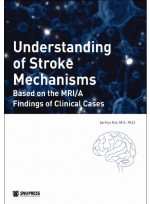 Understanding of Stroke Mechanisms-Based on the MRI/A Findings of Clinical Cases(뇌졸중기전)