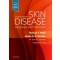Skin Disease, 4/e 