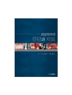 외상치아의 진단과 치료
