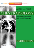 Chest Radiology, 6/e