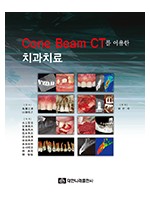 Cone Beam CT를 이용한 치과치료 