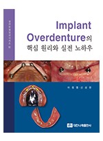 (실전보철임상시리즈 II) Implant Overdenture의 핵심 원리와 실전 노하우     