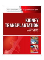 Kidney Transplantation - Principles and Practice, 7th Edition   