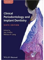 Clinical Periodontology and Implant Dentistry, 2 Volume Set 6th Edition 