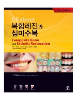 All about 복합레진과 심미수복