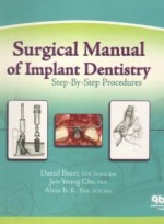 Surgical Manual of Implant Dentistry: Step-by-step Procedures [Hardcover]
