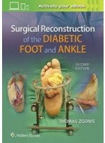 Surgical Reconstruction of the Diabetic Foot and Ankle, 2/e