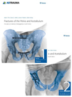 Fractures of the Pelvis and Acetabulum: Principles and Methods of Management, 4th   