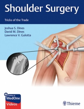 Shoulder Surgery Tricks of the Trade 