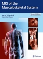 MRI of the Musculoskeletal System,2/e