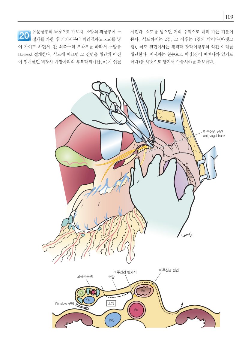 그림으로 보는 외과수술 아틀라스-복부 해부에 의한 수술 포인트   