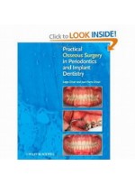  Practical Osseous Surgery in Periodontics and Implant Dentistry  