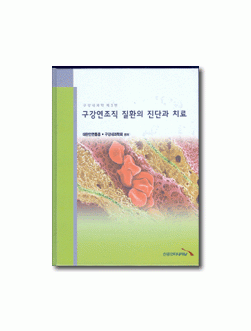 구강연조직 질환의 진단과 치료-구강내과학 제3편