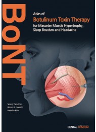 Atlas of Botulinum Toxin Therapy for Masseter Muscle Hypertrophy, Sleep Bruxism and Headache