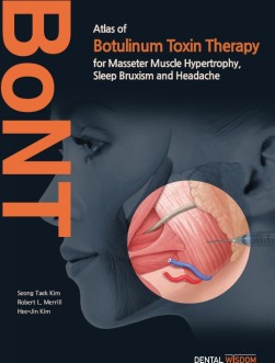 Atlas of Botulinum Toxin Therapy for Masseter Muscle Hypertrophy, Sleep Bruxism and Headache