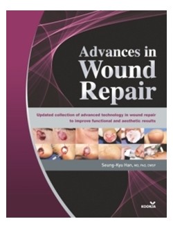 Advances in Wound Repair 