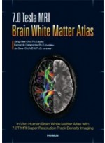 7.0 Tesla MRI Brain White Matter Atlas (번역서)