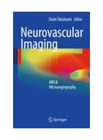 Neurovascular Imaging: MRI & Microangiography