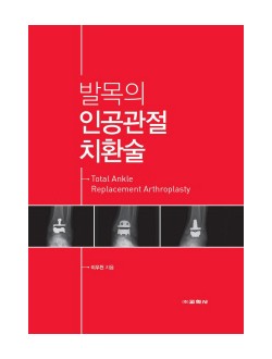 발목의 인공관절 치환술