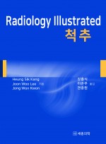 Radiology Illustrated : 척추  (번역본)