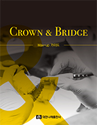 CROWN & BRIDGE - Wax-up 가이드 