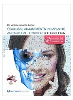 Occlusal Adjustments in Implants and Natural Dentition: 3D Occlusion 1st Edition 