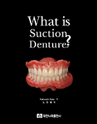 What is suction denture