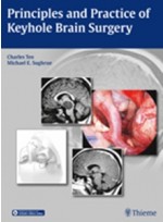 Principles and Practice of Keyhole Brain Surgery 