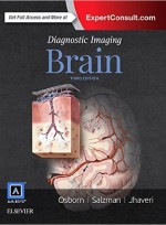 Diagnostic Imaging: Brain, 3e