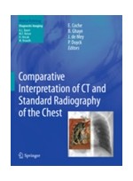 Comparative Interpretation of CT & Standard Radiography of the Chest