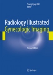 Radiology Illustrated: Gynecologic Imaging, 2/e