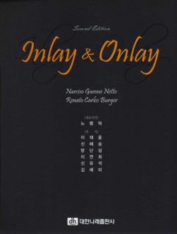 Inlay & Onlay 2nd Edition  