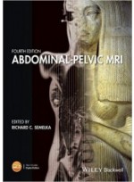 Abdominal-Pelvic MRI , 4/e