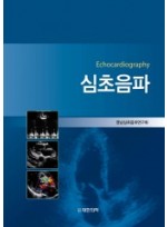 심초음파-Echocardiography 