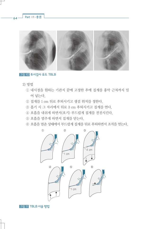 호흡기학 Manual