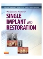 Principles and Practice of Single Implant and Restoration  