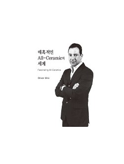 매혹적인 All-Ceramic의 세계  
