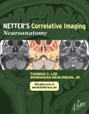 Netter's Correlative Imaging: Neuroanatomy-with NetterReference.com Access