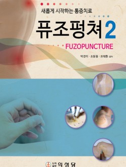 퓨조펑쳐2