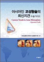 아시아인 코성형술의 최신지견 수술가이드
