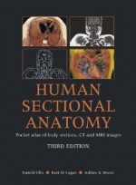 Human Sectional Anatomy Pocket Atlas of Body Sections, CT and MRI Images [Paperback]  3th