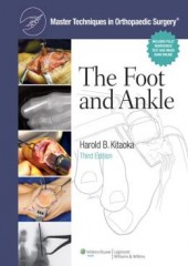 Master Techniques in Orthopaedic Surgery: Foot and Ankle, 3/e